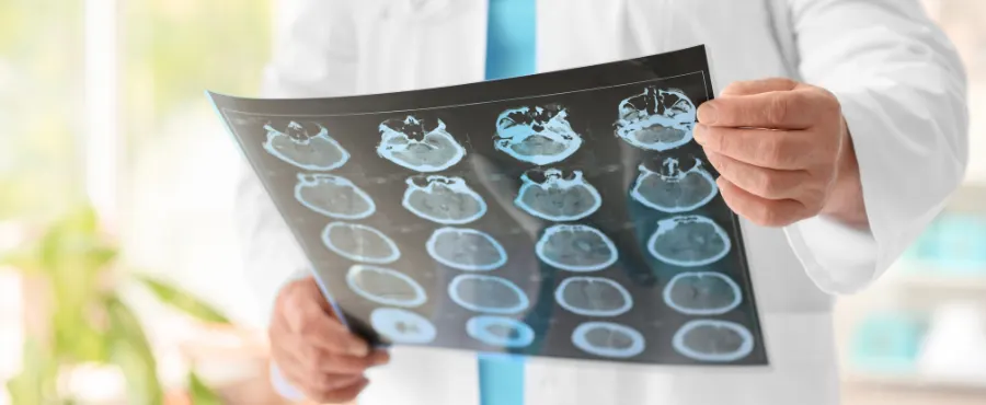 Neurologista clínico em Lavras onde encontrar