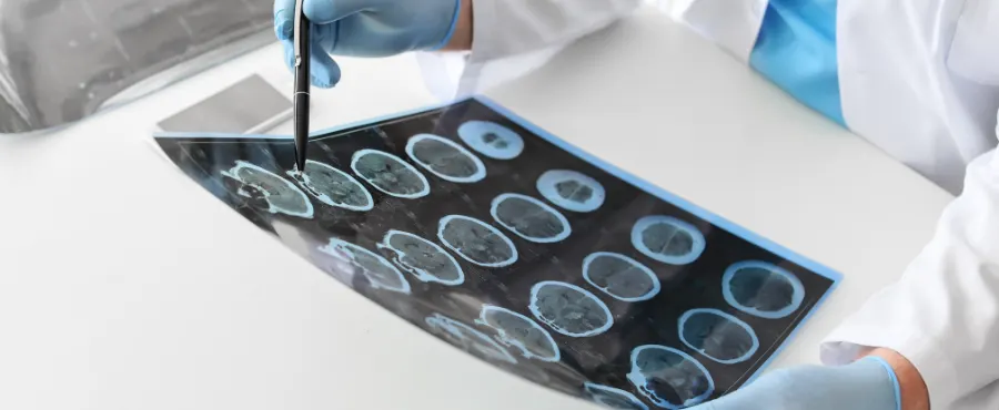 Neurologista clínico em Lavras