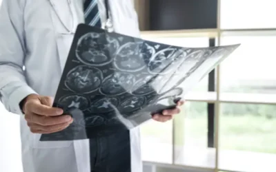 Especialista em Neurologia: quando procurar ajuda