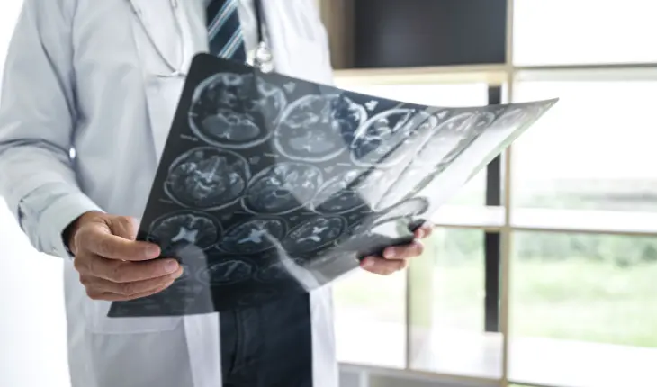 Especialista em Neurologia: quando procurar ajuda